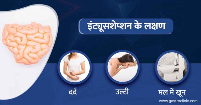 आंत का अटेक के अच्छे डॉक्टर