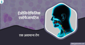 ईओसिनोफिलिक इसोफैजायटिस का इलाज