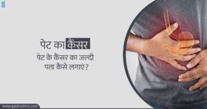 जठर कैंसर के अच्छे डॉक्टर