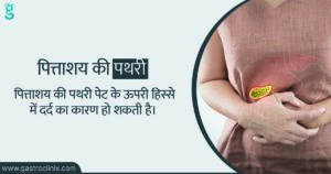 पित्ताशय की पथरी के स्पेशियालिस्ट