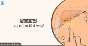 પિત્તાશય કાઢવાનું ના સ્પેશિયાલિસ્ટ અમદાવાદ માં