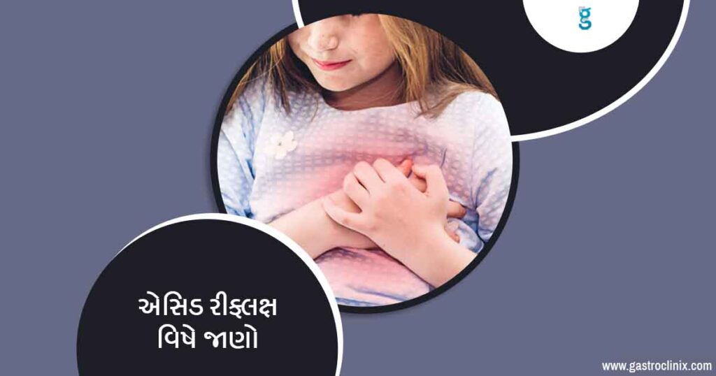 પિત્ત ઉપર ચડવું ના બેસ્ટ ડૉક્ટર