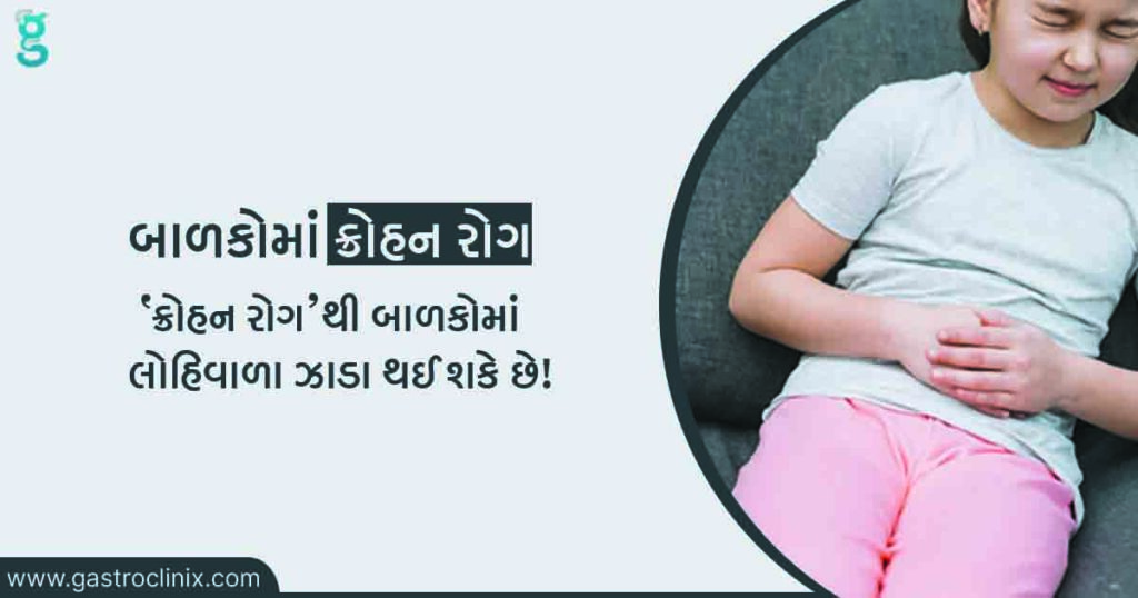 બાળકોમાં ક્રોહન રોગ ના બેસ્ટ ડૉક્ટર