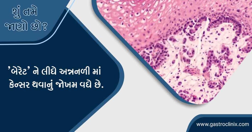 બેરેટ્સ અન્નનળી માટે શ્રેષ્ઠ હોસ્પિટલ અમદાવાદ માં