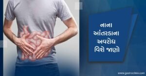 10. નાના આંતરડા Blog