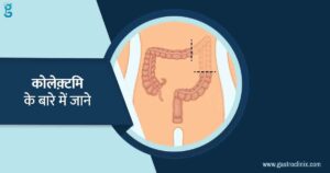 11. उच्छेदन यानी के कोलेक़्टमि blog