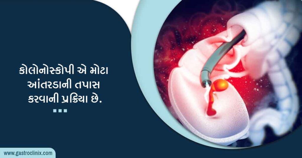 15. આંતરડા અને ગુદામાર્ગ કેન્સરની તપાસ blog