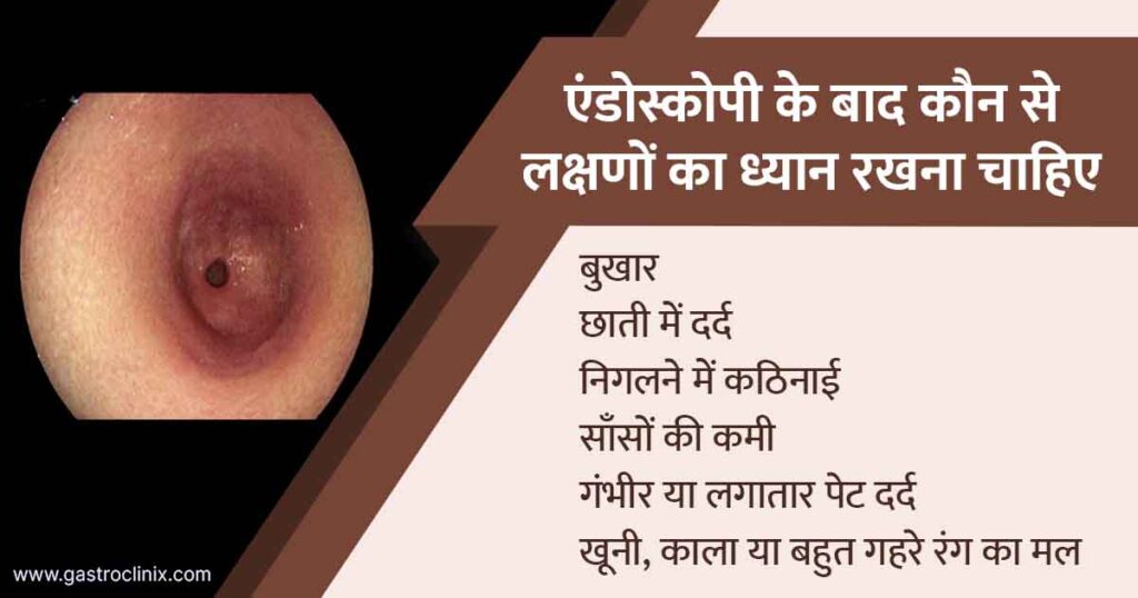 अपर एंडोस्कोपी 3 2 एंडोस्कोपी