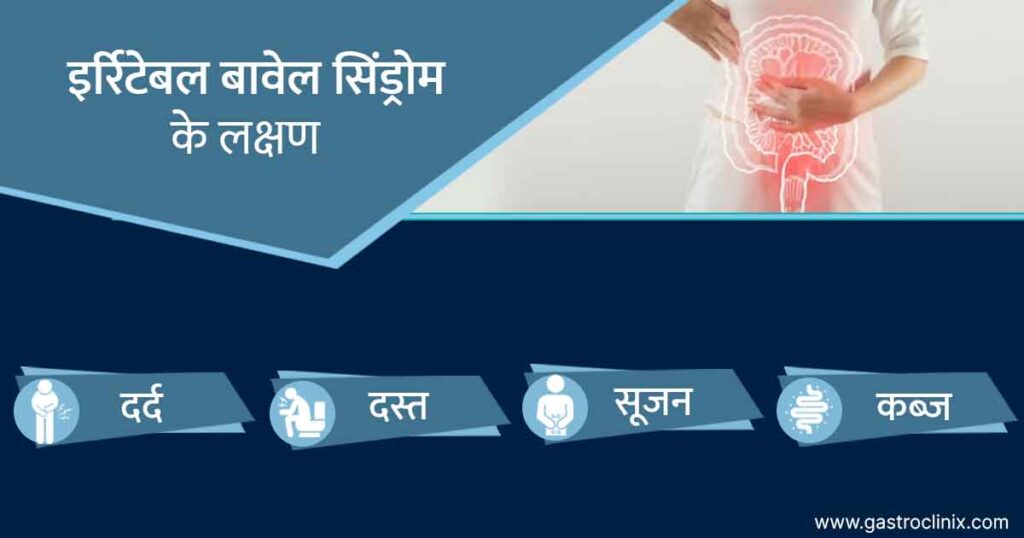 20. इर्रिटेबल बावेल सिंड्रोम blog