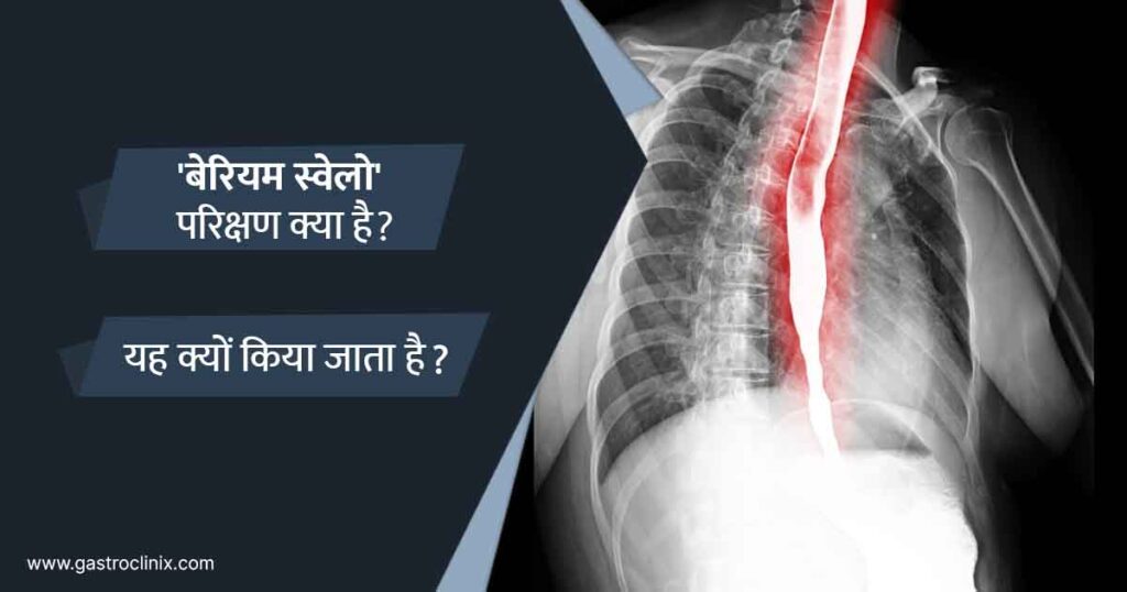 बेरियम स्वेलो 1 23. बेरियम निगल blog
