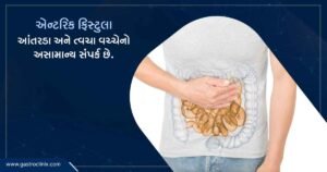 8. એન્ટરિક ફિસ્ટુલા Blog