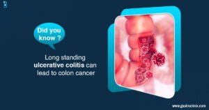 Best Doctor For Ulcerative Colitis In Adults