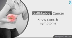 Best Hospital for Gallbladder Cancer Treatment