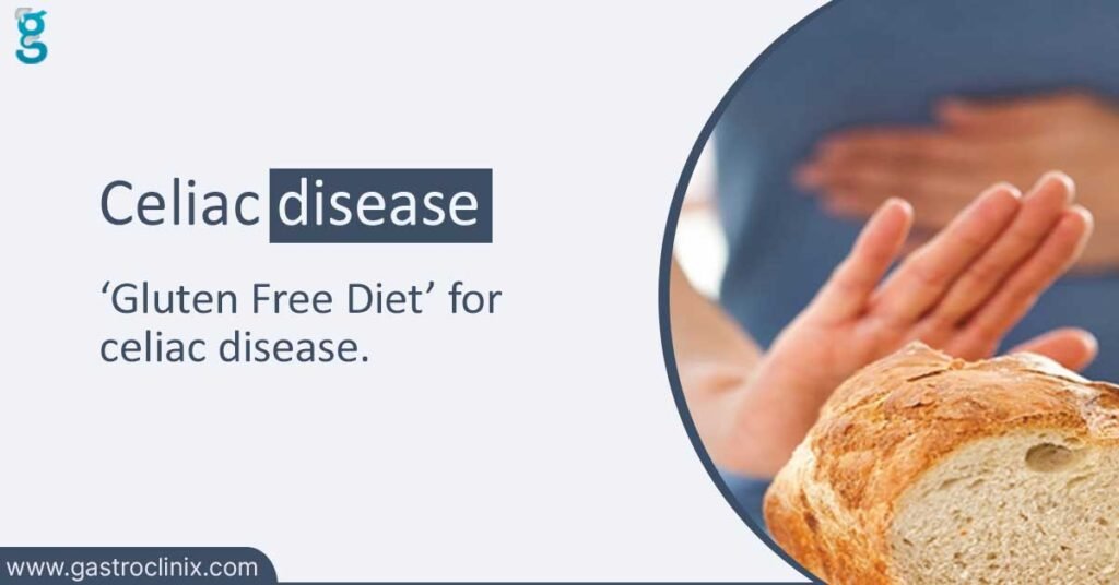 Celiac disease LN