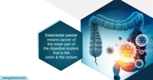Colorectal Cancer - Irregular pain in your abdomen - This could be a sign of cancer related to the intestines.