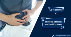 Ischemic Bowel Disease