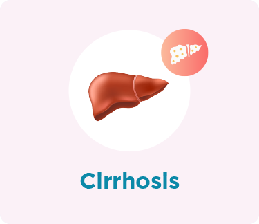 Liver Cirrhosis