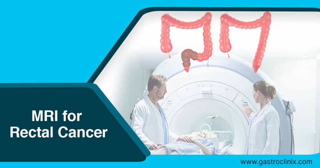 Rectal MRI 1 Rectal MRI eng