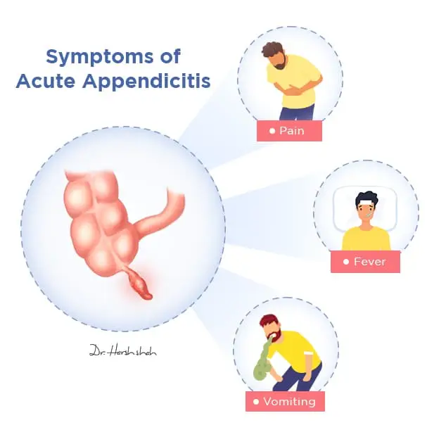 best appendicitis surgeon in ahmedabad