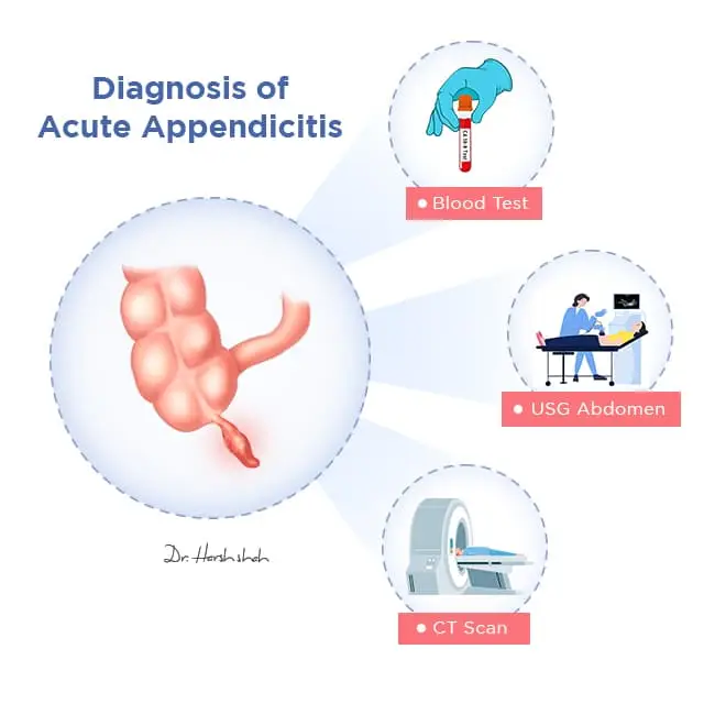 best appendicitis treatment in ahmedabad