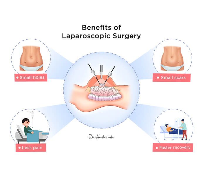 best gallbladder treatment doctor in ahmedabad