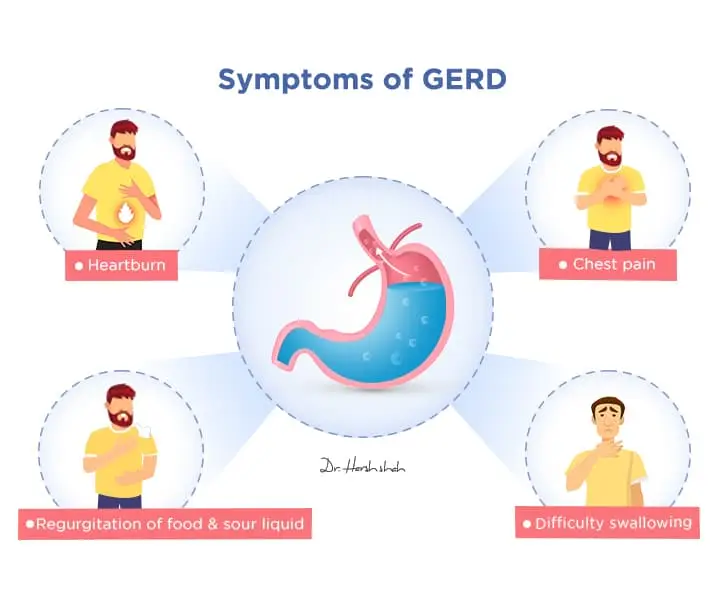 best gerd hospital in ahmedabad