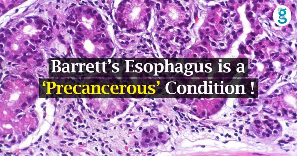 esophagus barrett english