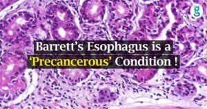 Esophagus Barrett English
