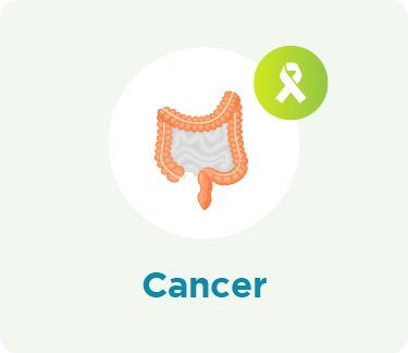 large bowel Cancer