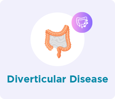 large bowel Diverticular Disease