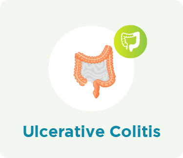 large bowel Ulcerative Colitis