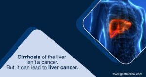 liver cirrhosis eng