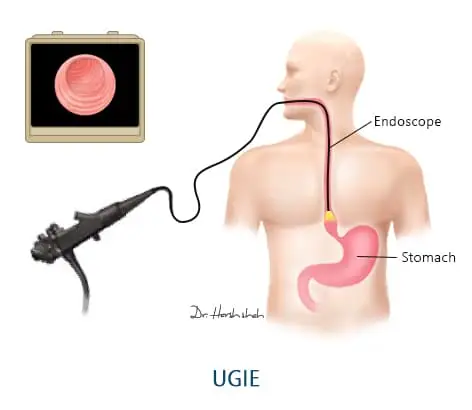 no 1 gerd doctor in ahmedabad