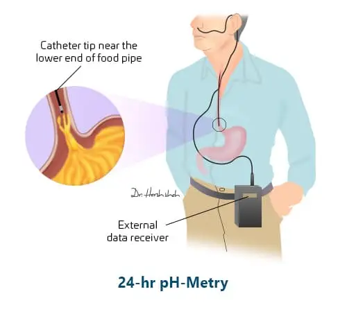 no 1 gerd treatment in ahmedabad