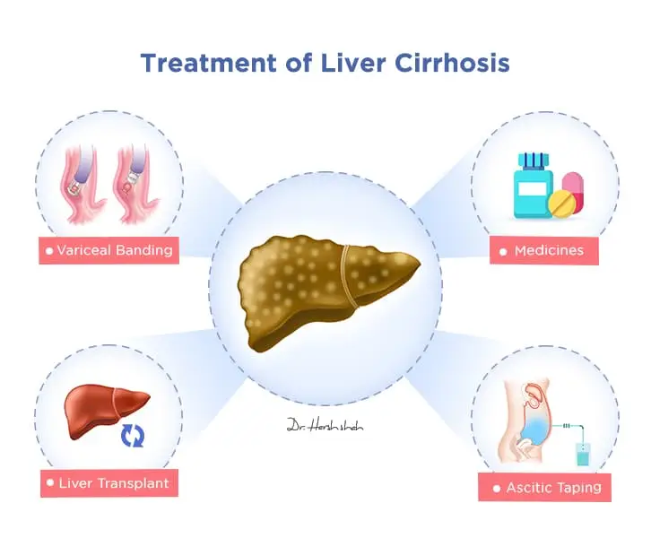 no 1 liver cirrhosis treatment in ahmedabad