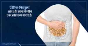 एंटेरिक फिस्टुला के स्पेशियालिस्ट