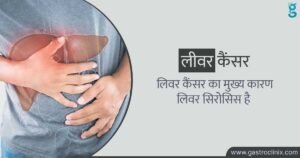 यकृत कैंसर