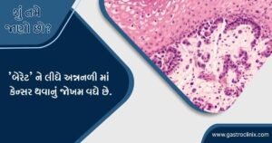 બેરેટ્સ અન્નનળી માટે શ્રેષ્ઠ હોસ્પિટલ અમદાવાદ માં