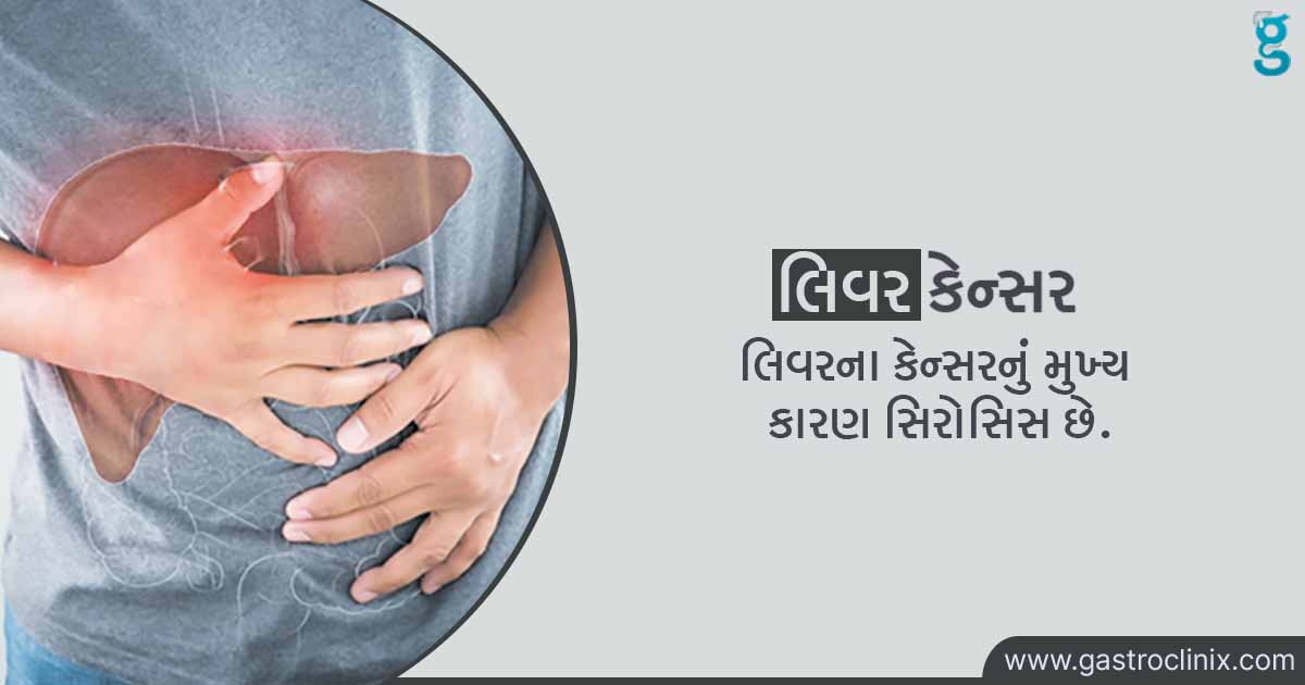 યકૃતનું કેન્સર - યકૃતનું (લીવર) કેન્સર