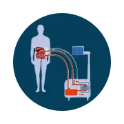 top notch crs + hipec surgeon in Ahmedabad