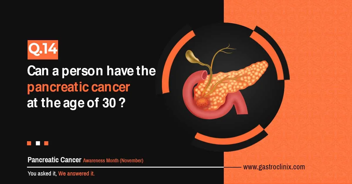 Can a person have pancreas cancer at 30 years of age