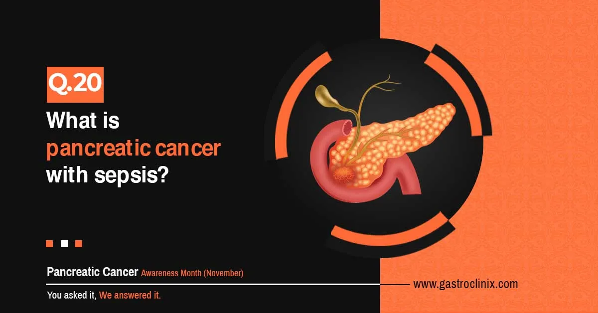 What is pancreatic cancer with sepsis
