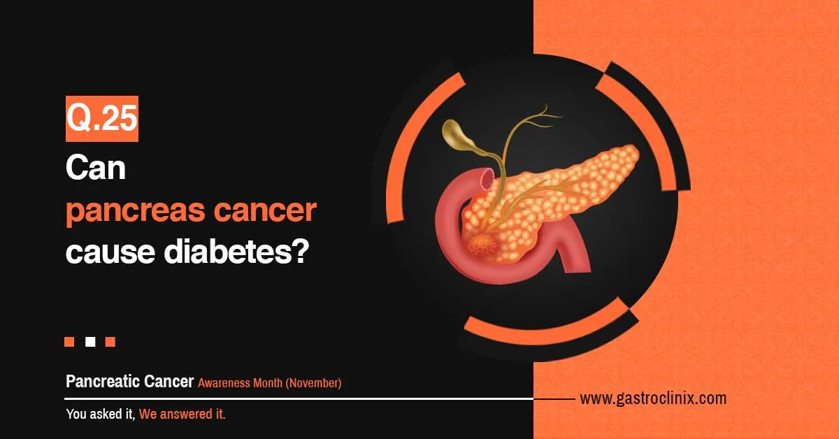 Can pancreas cancer cause diabetes