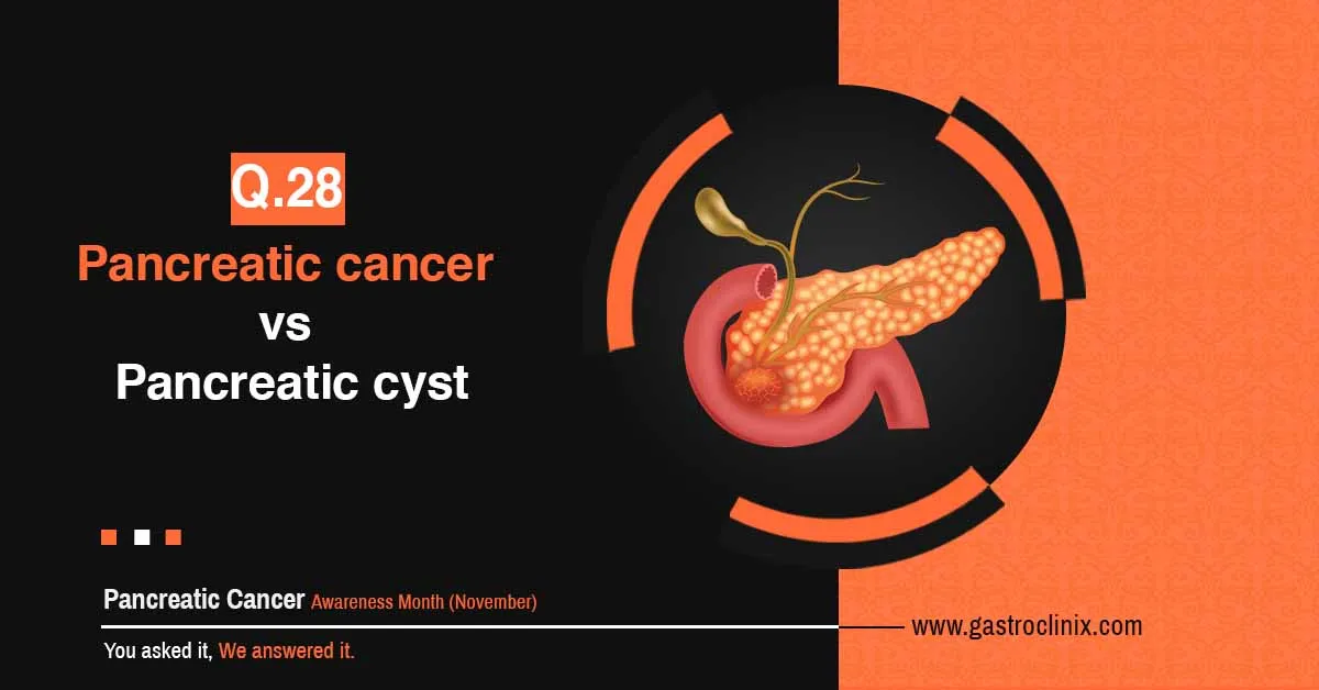 Pancreatic cancer vs. Pancreatic cyst