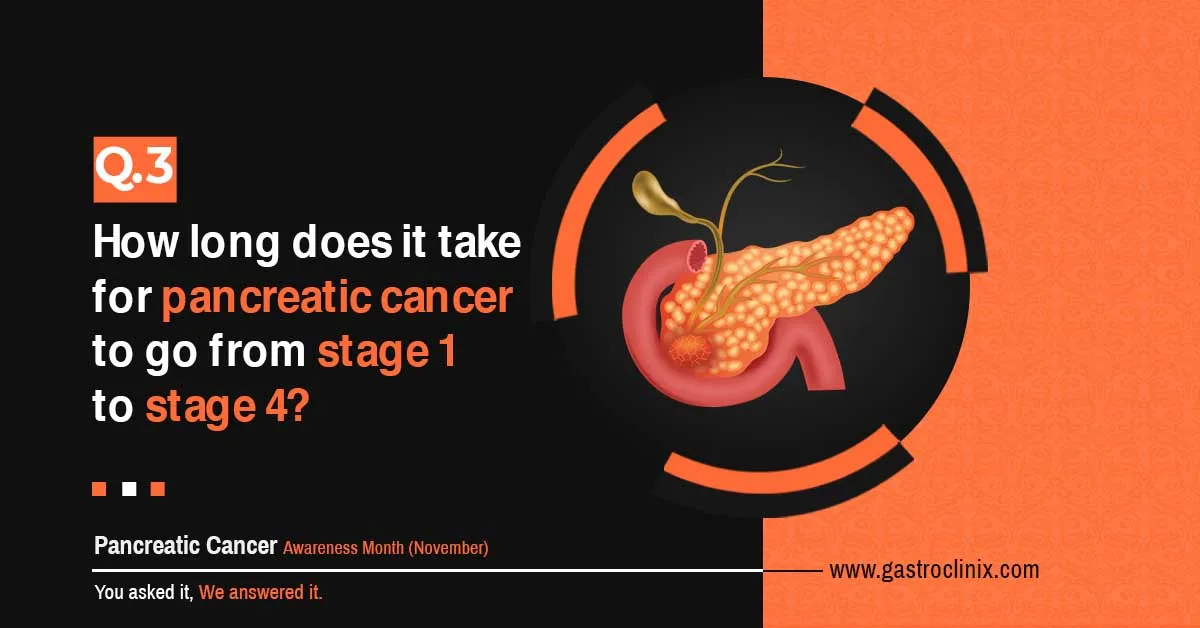 How long does it take for pancreatic cancer to go from Stage 1 to Stage 4