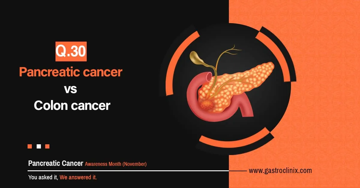Pancreatic Cancer - Frequently Asked Questions - Section 3 10 Pancreatic cancer vs. Colon cancer