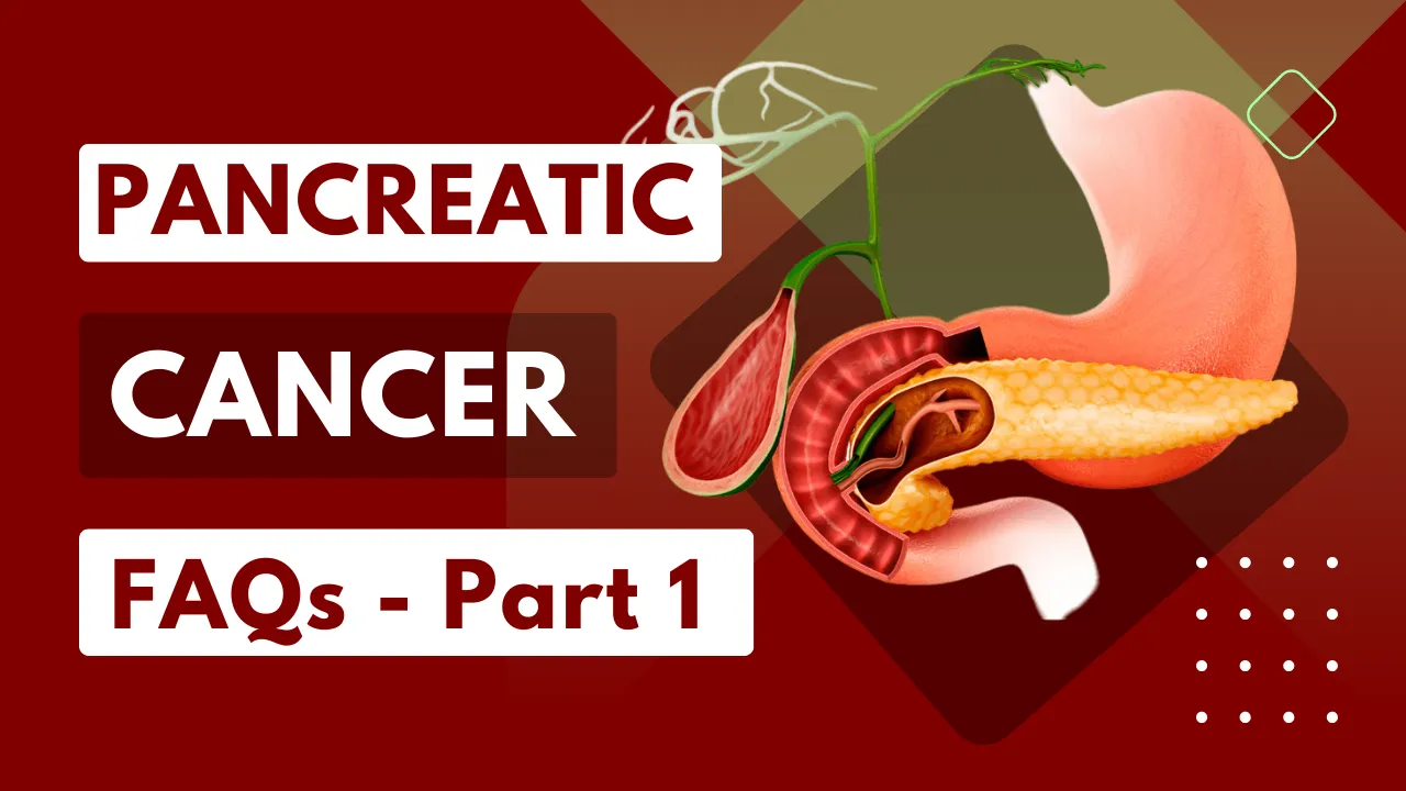 Pancreatic Cancer Frequently Asked Questions Part 1