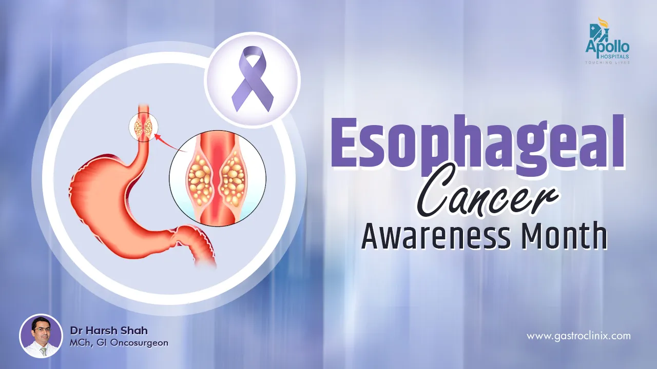 Esophageal Cancer Awareness Month