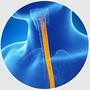 esophageal treatment