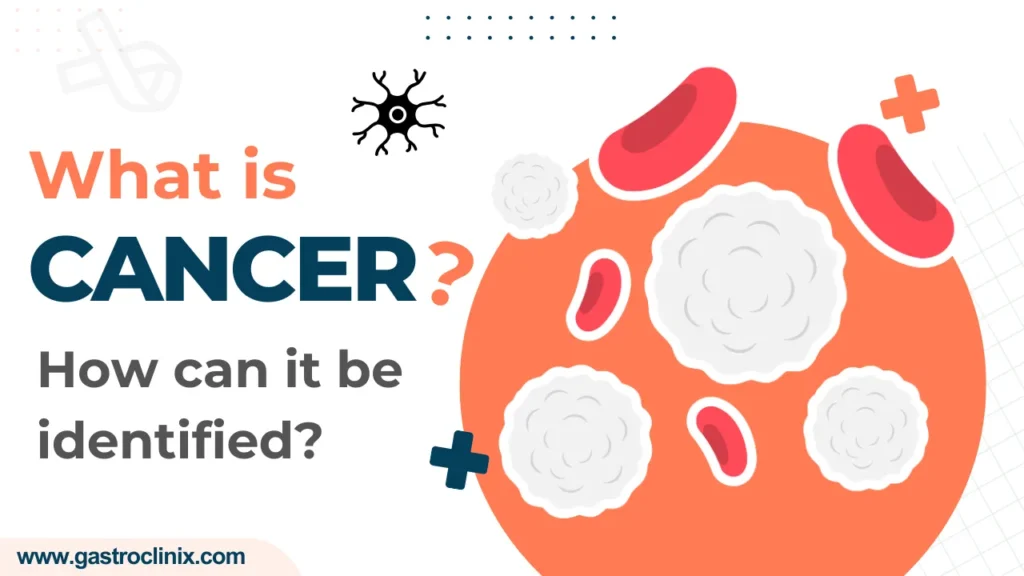 Cancer - Causes, Symptoms, Treatment, Prevention
